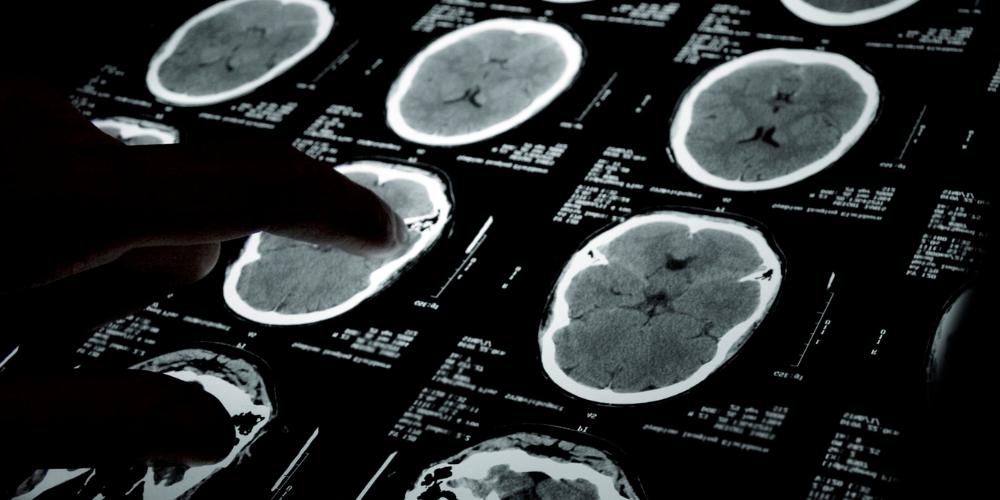 Where AI is Reshaping Imaging for Oncology Drug Development